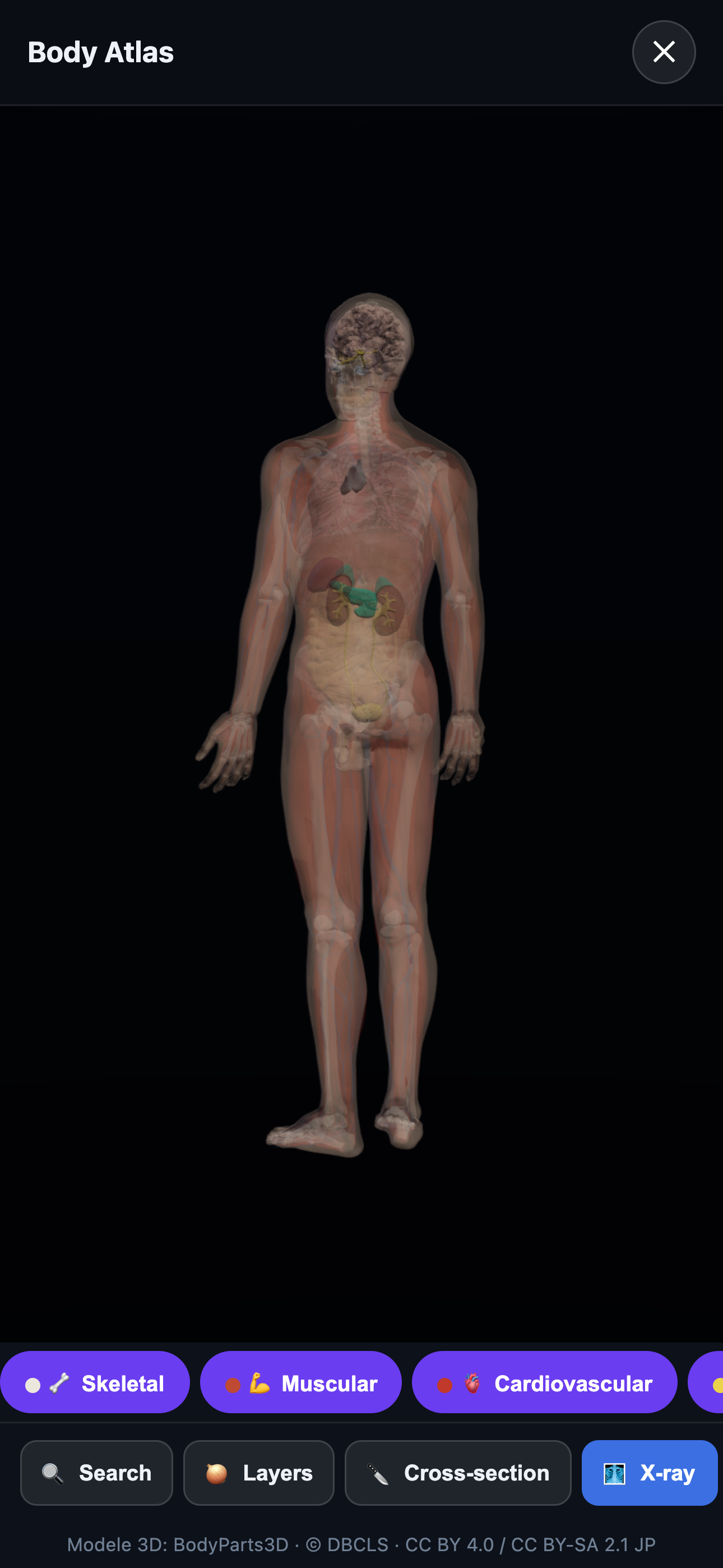 Body Atlas — X-ray